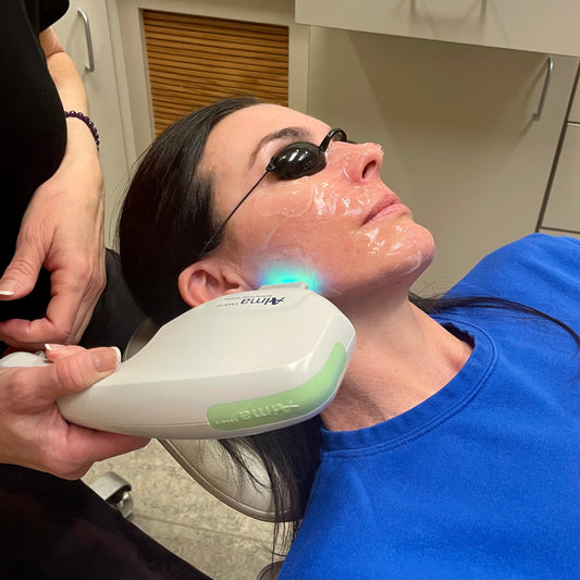 IPL Full Face (Intense Pulsed Light)