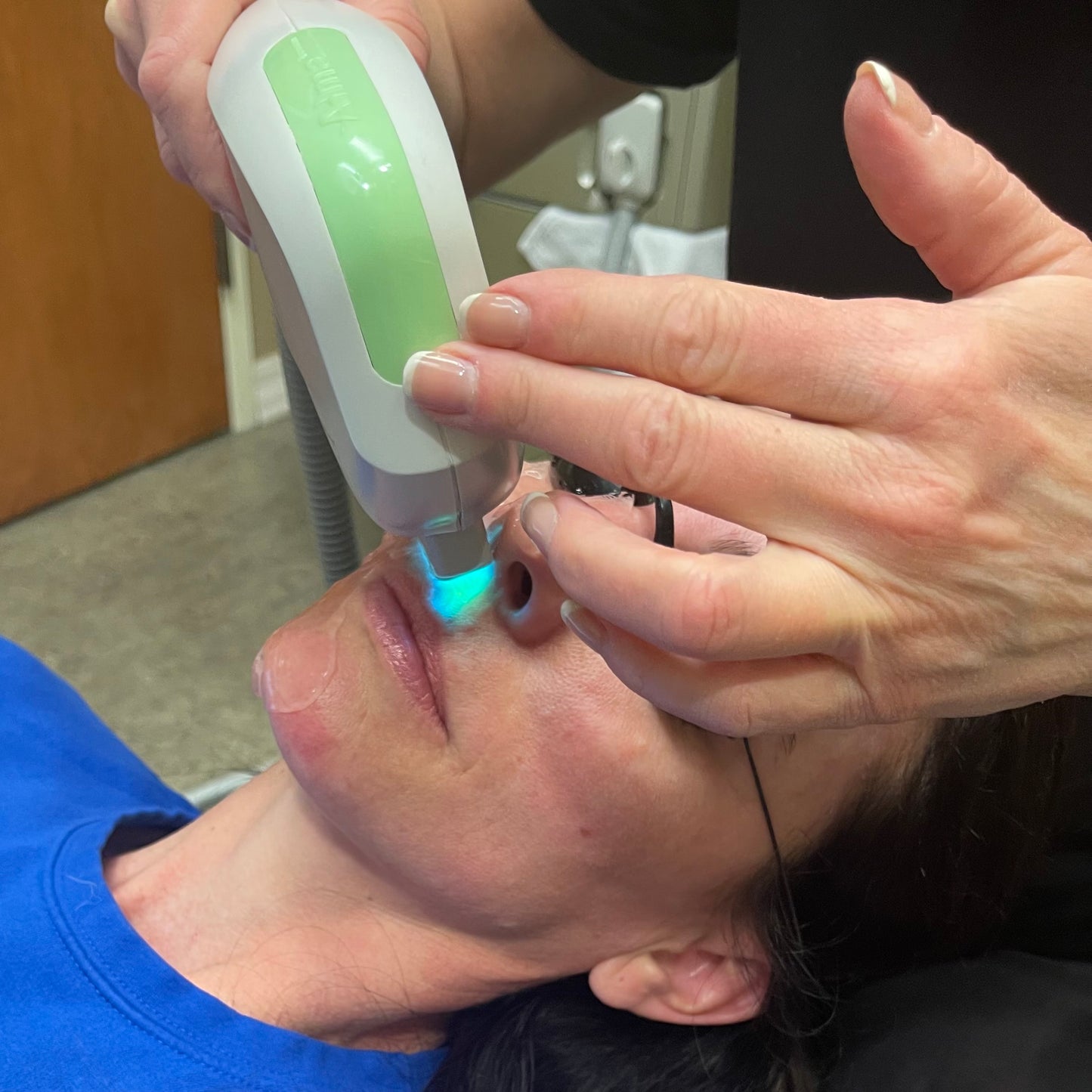 Laser Hair Removal- Lip and Chin