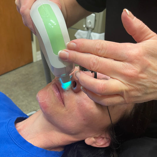 Laser Hair Removal- Lip or Chin